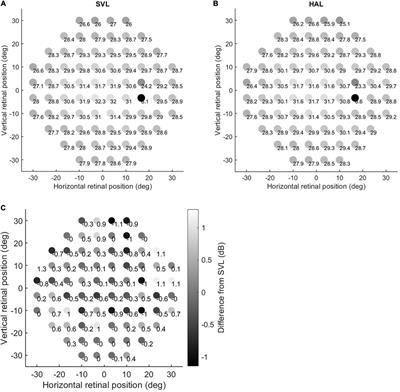 Spectacles with highly aspherical lenslets for myopia control do not change visual sensitivity in automated static perimetry
